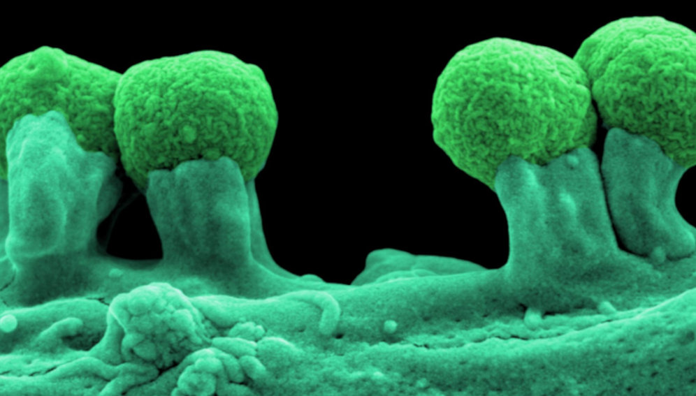 A magnified image of E.coli.