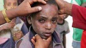 Toilette du visage et accès à l’eau: des mesures pour prévenir le trachome