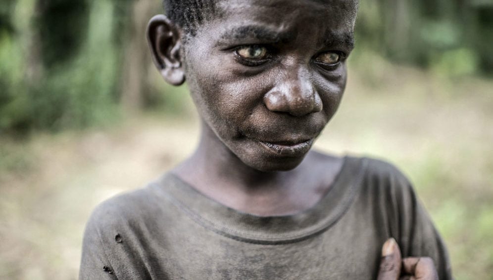a blind Mbuti Pygmy residing in Upende village