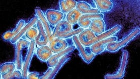 L’Afrique de l’Ouest se mobilise contre le virus Ebola