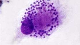 Des tests de diagnostic rapides ‘pourraient détecter le Kala-azar’