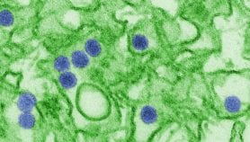Zika: le mystère d’un code génétique clé percé