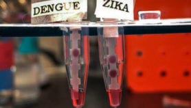 Un test permet de différencier les infections aux virus Zika et dengue