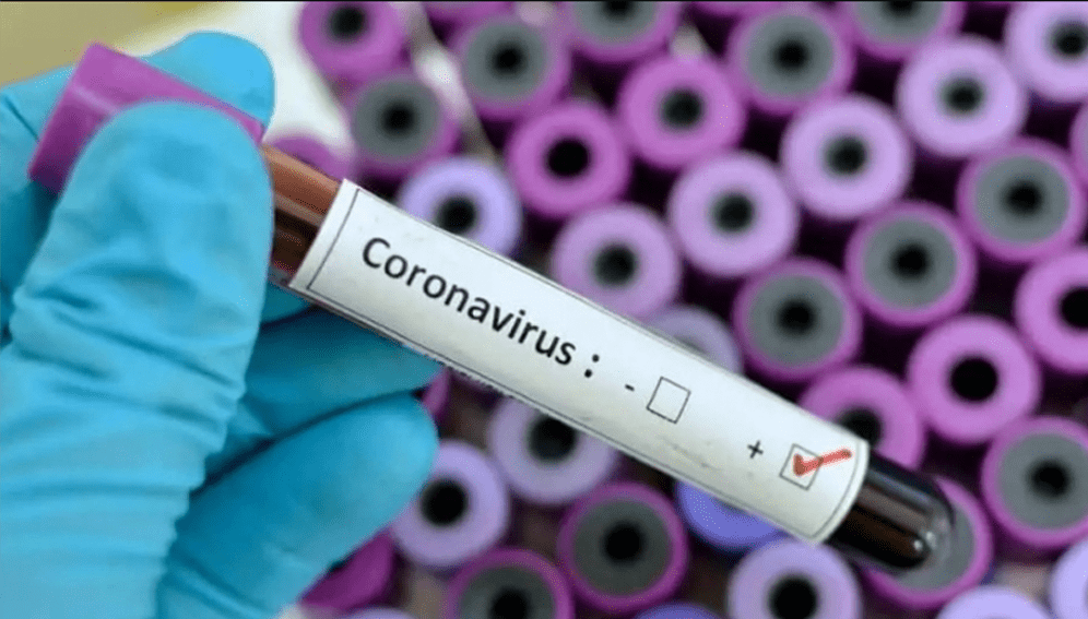 Coronavirus Bottle