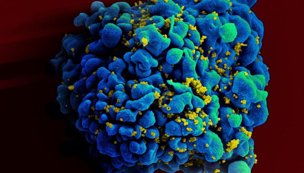 HIV-infected cell