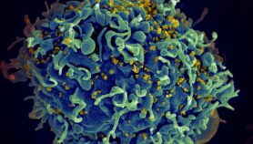 Sida : Les ARV empêchent la propagation d’un dangereux variant du VIH