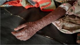 Le Sénégal se débarrasse du Mpox qui est en net recul en Afrique