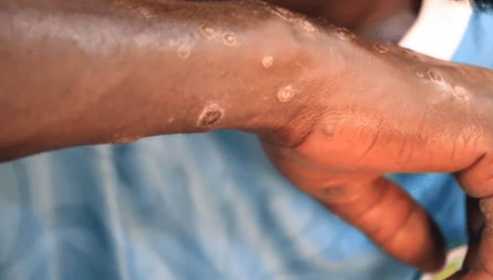 Le mystère persiste sur une maladie qui touche les pêcheurs sénégalais -  Afrique Sub-Saharienne