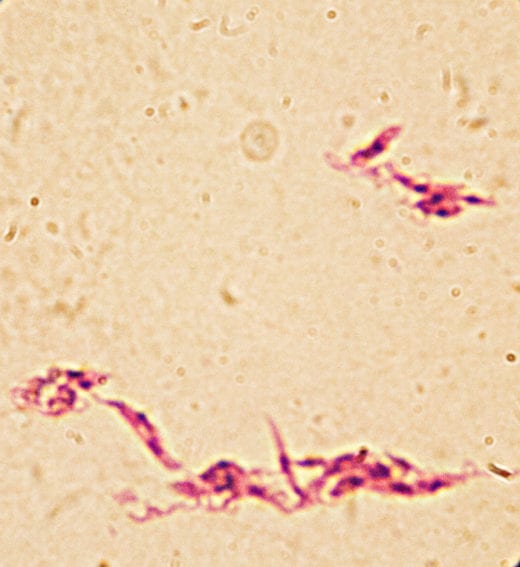 Microscope image of the leishmania parasite (purple). At this stage of its life cycle, it is known as a promastigote. The parasite develops into this form in the sand fly and is then transmitted through bites
