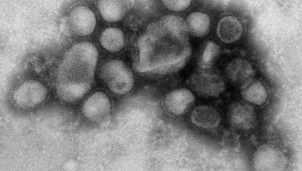 H1N1_flu_CDC