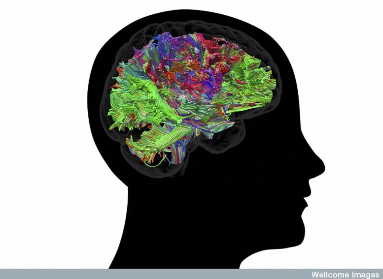 human brain by wellcome images