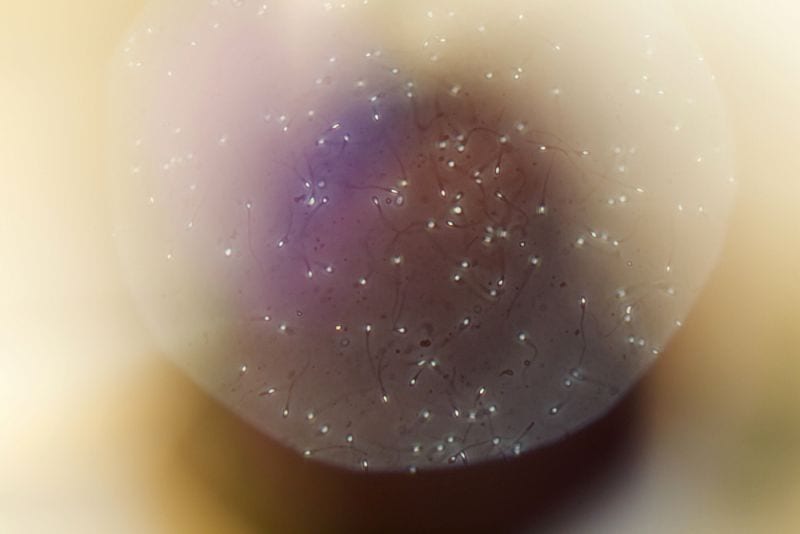 Live sperm as seen through a microscope