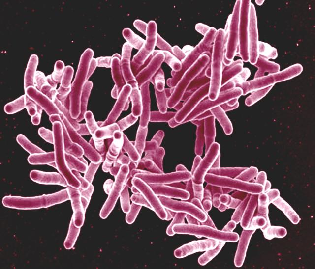 Mycobacterium tuberculosis byNational Institute of Allergy and Infectious Diseases