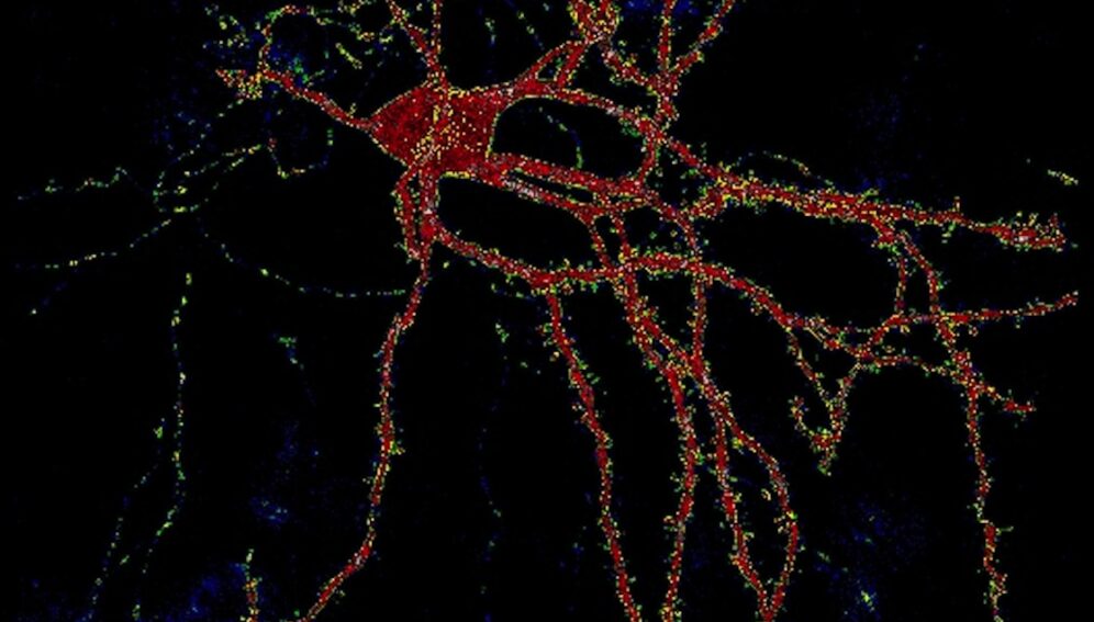 neurona_Margaret_Davis_NIH.jpg