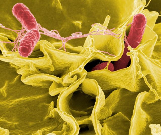 Salmonella Bacteria NIAID