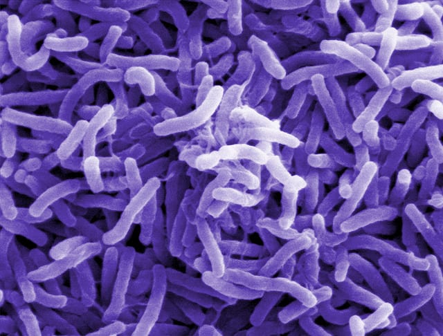 Vibrio cholerae Sanofi