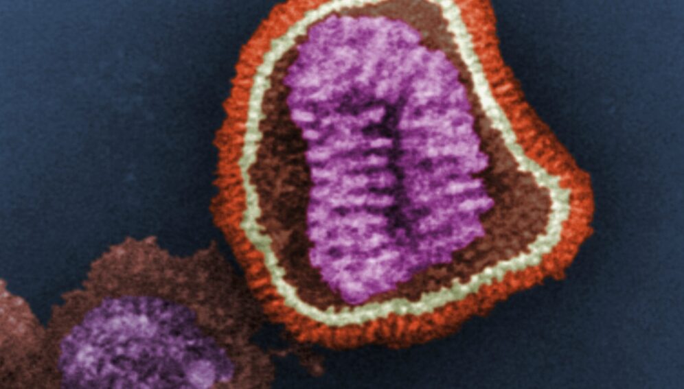 virsu-influenza-CynthiaGoldsmith-CDC