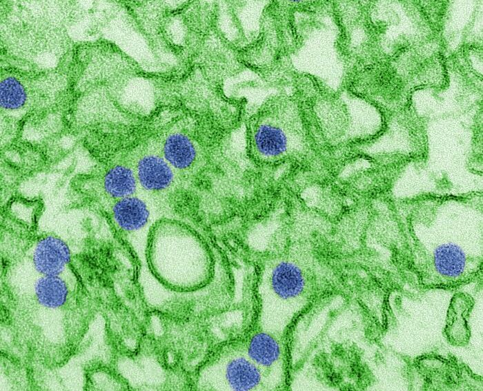 zika virus, blue by cdc