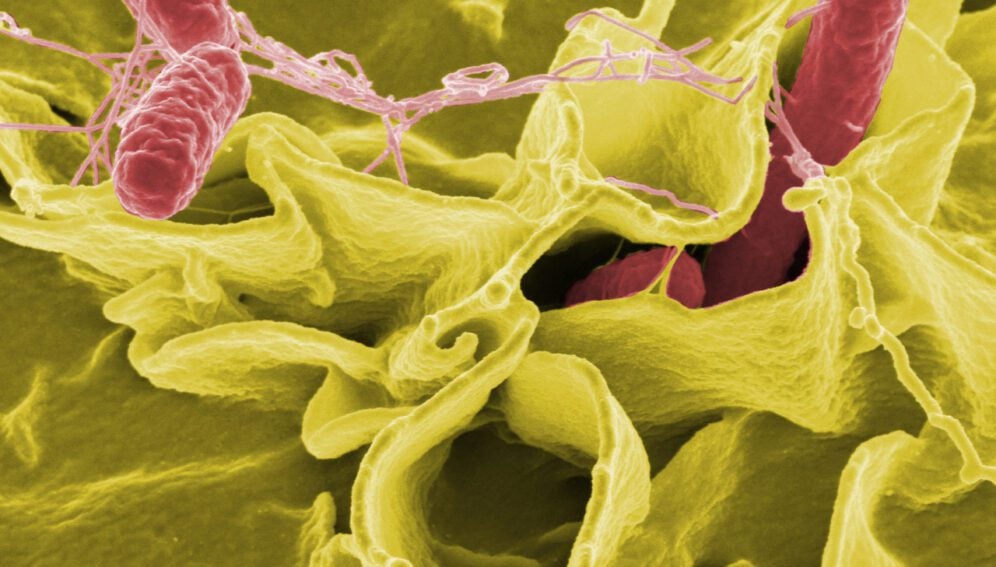 Credit: Rocky Mountain Laboratories,NIAID,NIH
Color-enhanced scanning electron micrograph showing Salmonella typhimurium (red) invading cultured human cells.