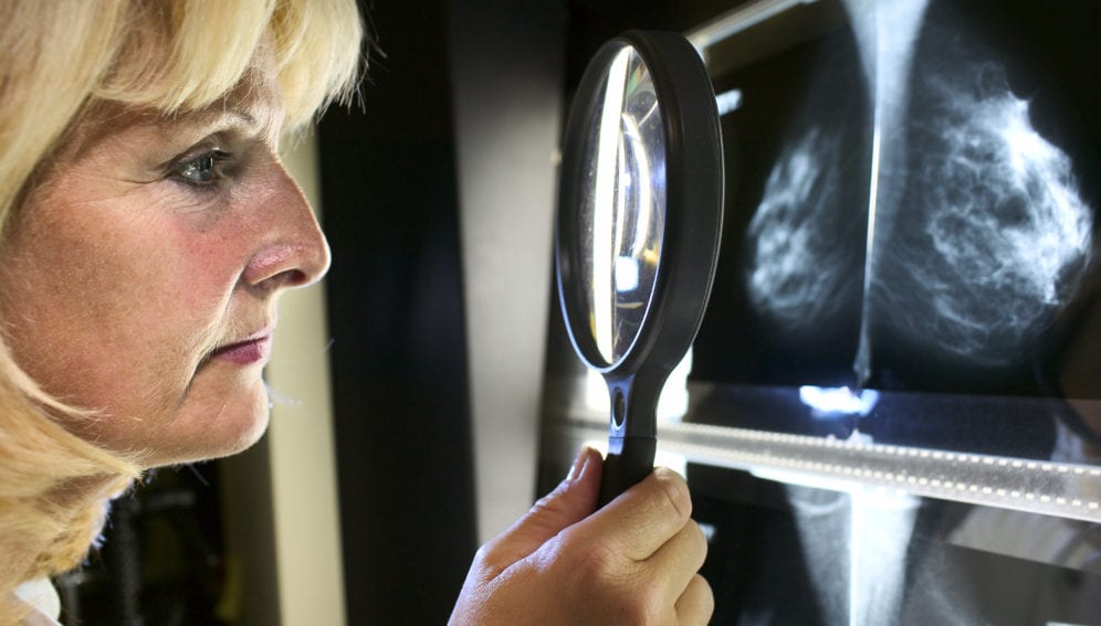 doctor checking mammogram image
