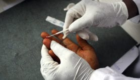 Malaria test adapted to predict treatment side-effects