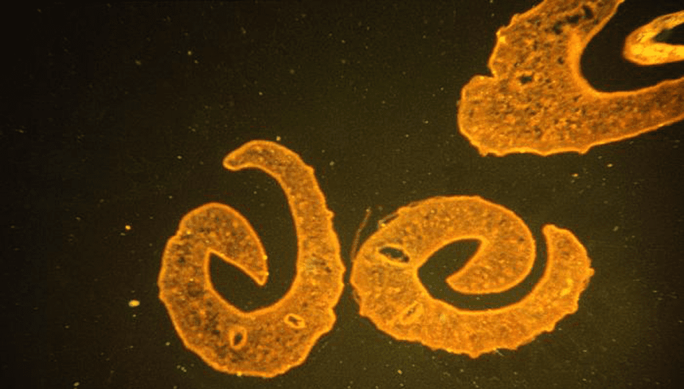 Schistosoma mansoni - main article