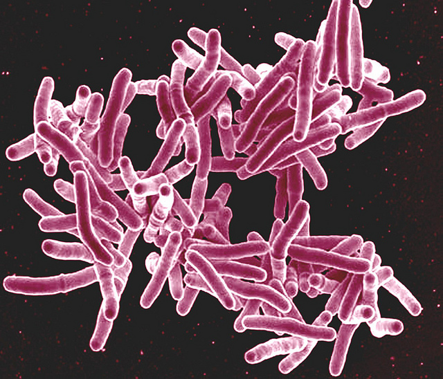 Tuberculosis_Flickr_Microbe World