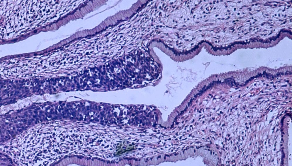 hpv-in-situ
