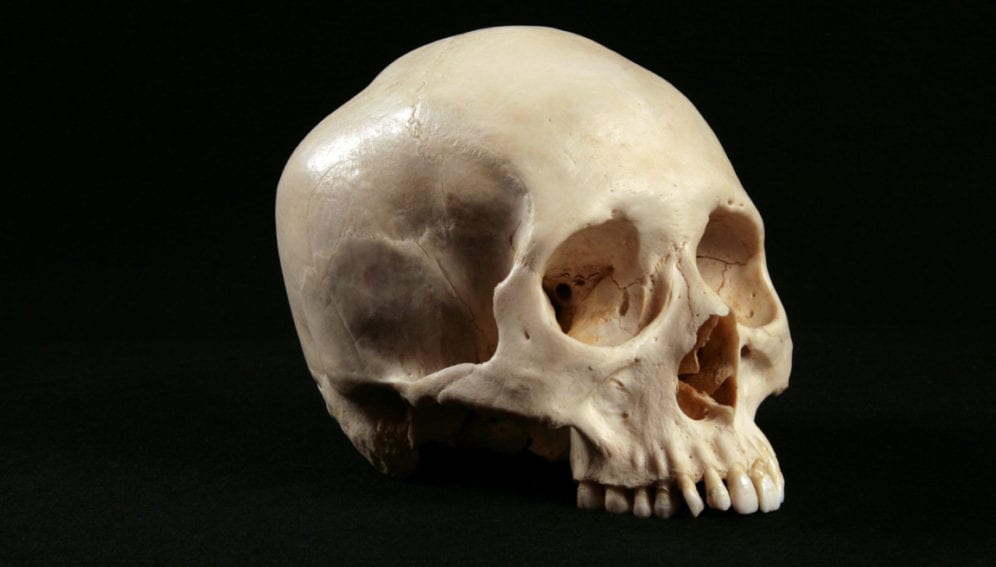 Skull forensics