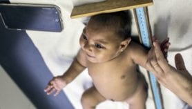 Focus on Disability: ‘Zika babies’ need support now