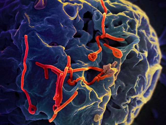 Ebola virus NIAID