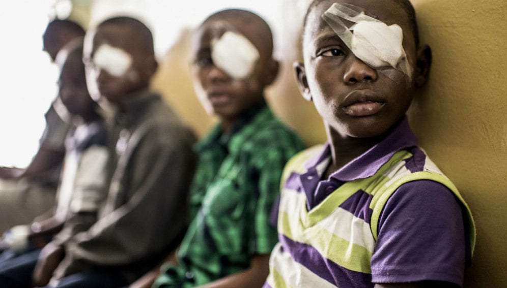 eye surgery at the Mnazi Mmoja hospital