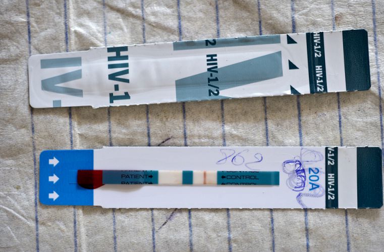 HIV test strips