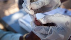 HIV treatment as prevention in Africa