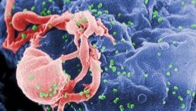 Stigmatisation, ignorance still rife 35 years after HIV revealed as cause of AIDS