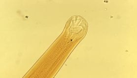 Hookworm genome sequence helps identify drug candidates