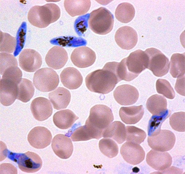malaria parasites