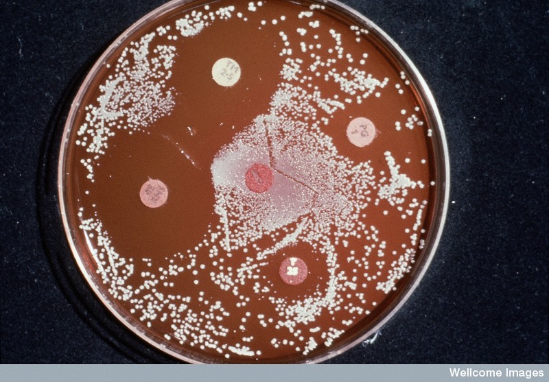 Penicillin-resistant bacteria_Wellcome Images.jpg