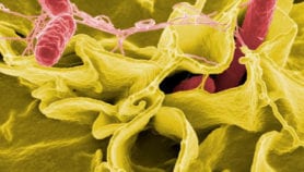 Virulent Salmonella strain spotted in Brazil