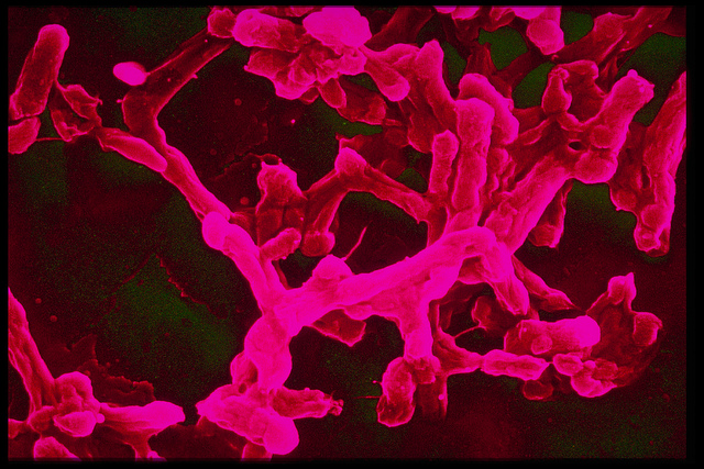 Typhoid_Flickr_Sanofi Pasteur