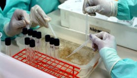 New blood test to detect Zika approved in Brazil