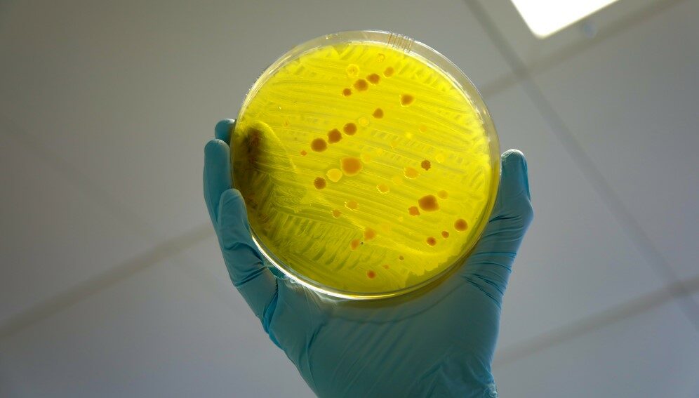 A variety of different bacteria - testing for antimicrobial resistance