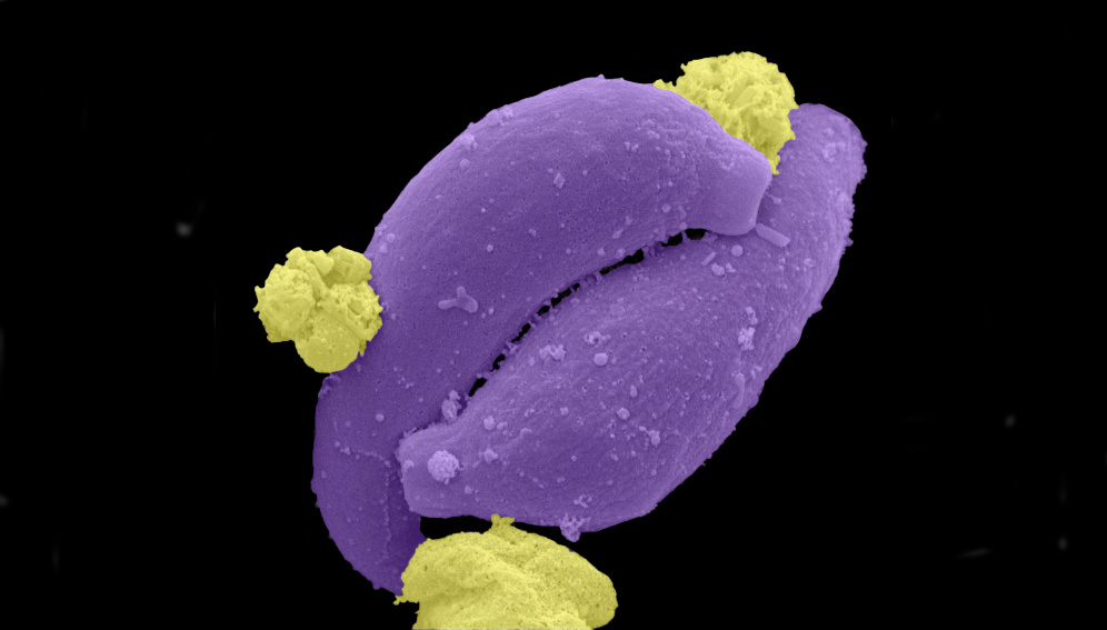 Credit Plasmodium ookinetes, malaria parasite life cycle, SEM. Leandro Lemgruber, University of Glasgow. Attribution 4.0 International (CC BY 4.0). Source: Wellcome Collection.