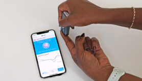 Smartphone operated tool uses light beam to detect malaria