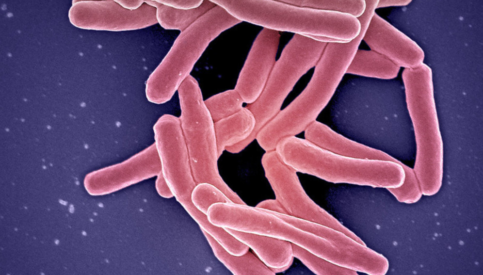 More funding is needed to combat Koch's bacillus, the bacteria responsible for tuberculosis. Image credit: NIAID ( CC BY 2.0 )