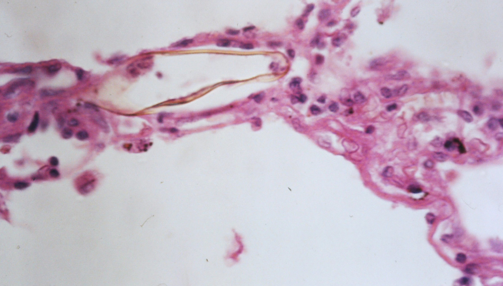 Last-mile surveillance can end neglected diseases—study