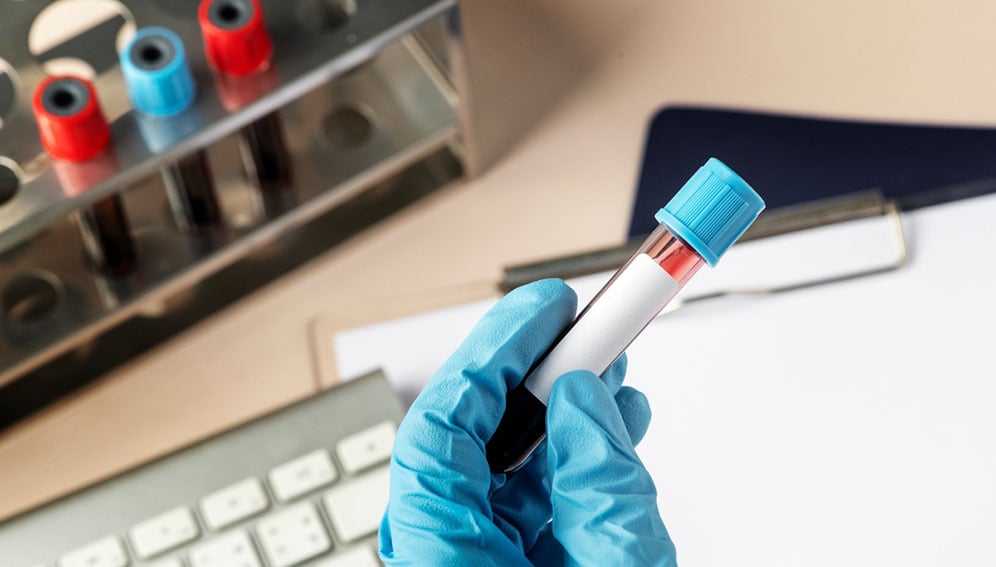 New blood test speeds childhood cancer diagnosis