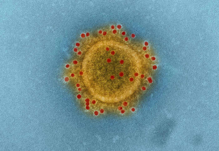 MERS COrona virus NIAID in collaboration with Colorado State University.jpg
