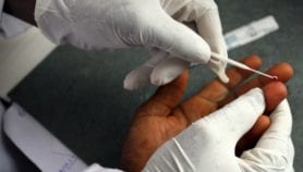 تشخيص الملاريا بمثل اختبار الحمل