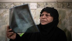 العلاجات الجديدة للسل تثبت نجاعة في العراق